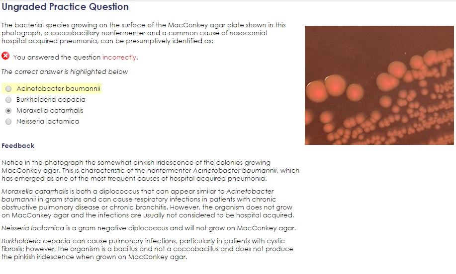 ASCP Knowledge ASCP-MLT Points | Exam ASCP-MLT Vce Format