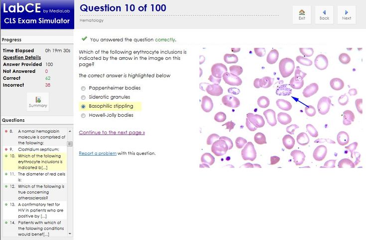 PEGACPBA88V1 Valid Exam Duration | PEGACPBA88V1 Reliable Braindumps Sheet