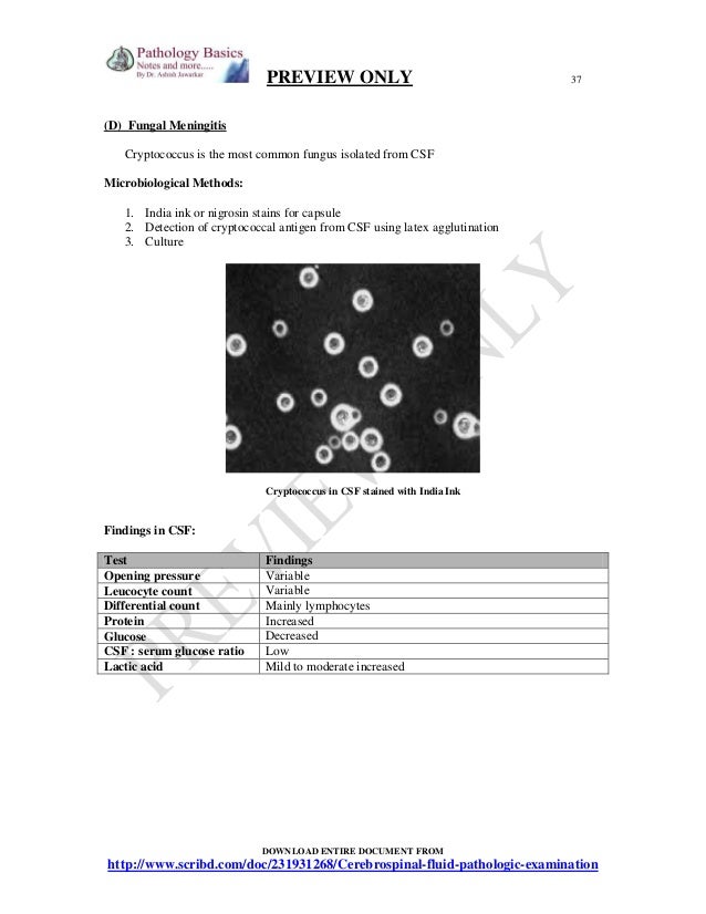 D-CSF-SC-23 Study Materials - D-CSF-SC-23 Reliable Braindumps Questions