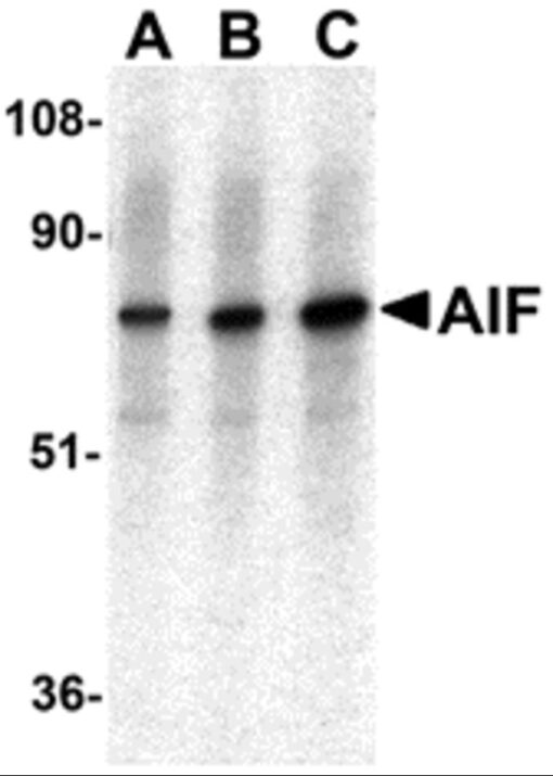 AIF Pass Guide - BCS AIF Test Assessment, Actual AIF Test Pdf