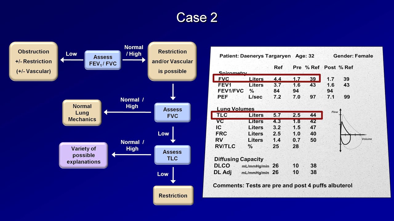 D-PST-DY-23 Reliable Braindumps Questions & Reliable D-PST-DY-23 Test Guide