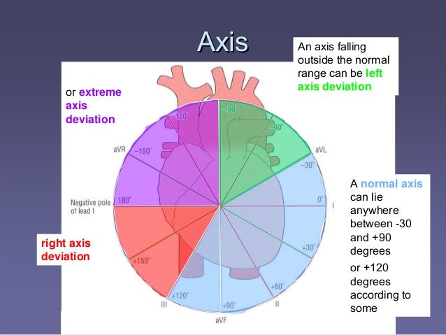 ANVEオンライン試験 & Axis ANVE技術試験、ANVE模擬対策問題